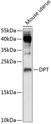 Western Blot: Dermatopontin Antibody [NBP2-92566] - Western blot analysis of extracts of mouse uterus, using Dermatopontin Antibody (NBP2-92566) at 1:1000 dilution. Secondary antibody: HRP Goat Anti-Rabbit IgG (H+L) at 1:10000 dilution. Lysates/proteins: 25ug per lane. Blocking buffer: 3% nonfat dry milk in TBST. Detection: ECL Basic Kit. Exposure time: 90s.